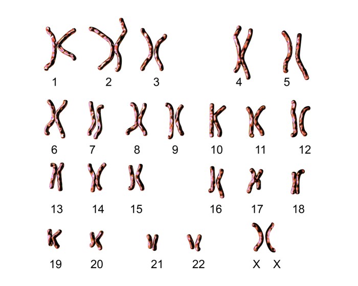 Karyotyping chromosome karyotype ignore chromosomes homework