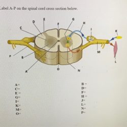 Spinal unlabeled transparent vhv