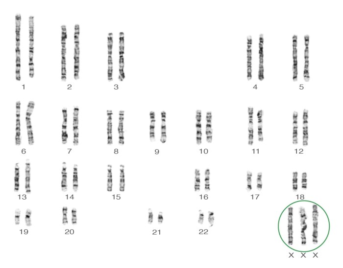 Human karyotyping gizmos answer key