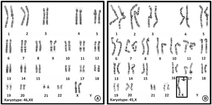 Gizmos studocu karyotyping