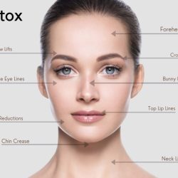 Botox