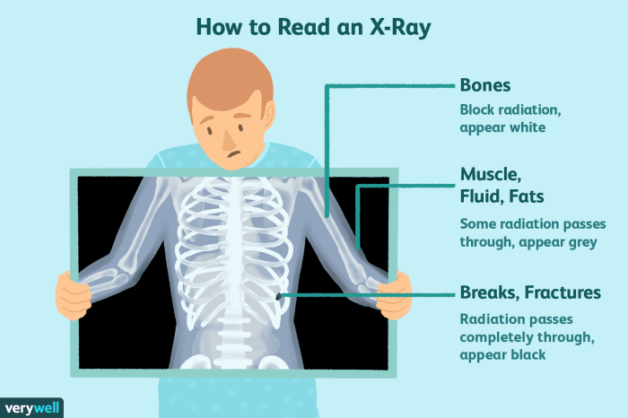 What are three advantages of digital x-rays over film